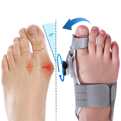 Amalfi™ Bunion Corrector